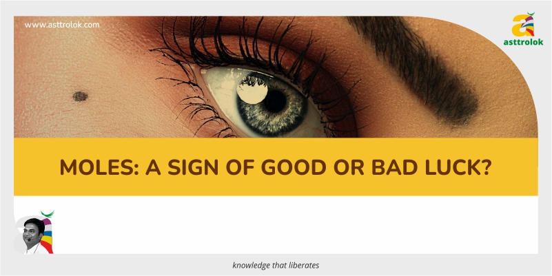 Moles: a sign of good or bad luck?